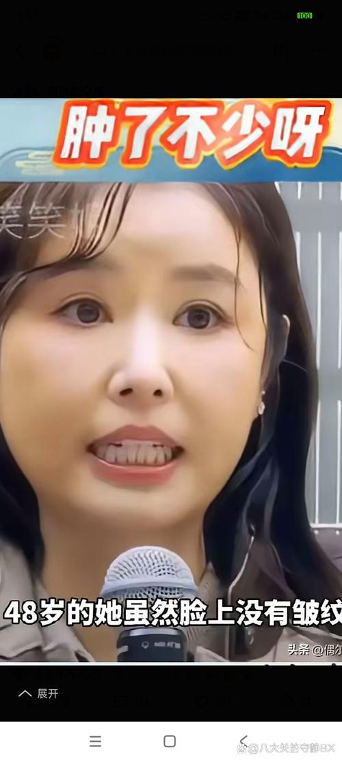 2025新澳门精准正版图库网站和陈意涵医美后脸歪了与陈意涵医美后脸歪了是真的吗